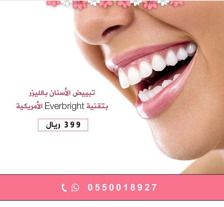 تبيض الاسنان بالليزر في الرياض من مركز ماجستيك ميلينيوم 0550018927  P_7323msf60